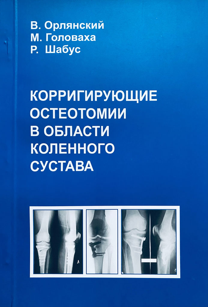 После остеотомии коленного сустава. Корригирующая остеотомия. Корригирующая остеотомия коленного сустава. Корригирующие околосуставные остеотомии. Корригирующая остеотомия голени.